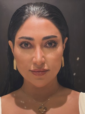 Alaa